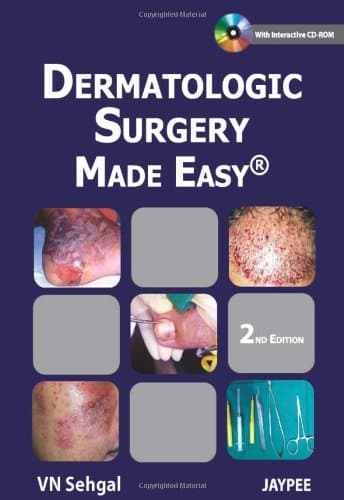 Dermatologic Surgery Made Easy