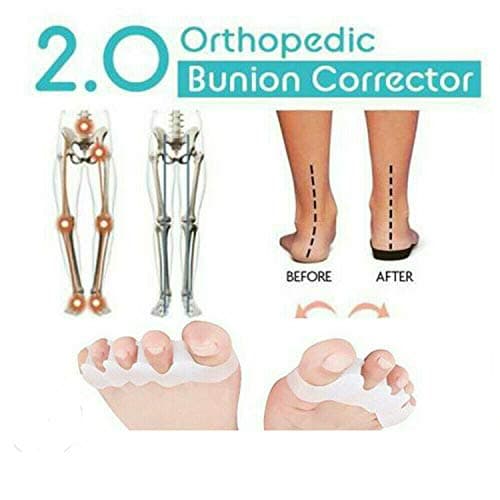 2019 Orthopedic Bunion Corrector 2.0 (1 Pair)