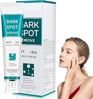 Dark Spot Removal Whitening Freckle Cream, 50ml, Brightening & Smoothing Formula